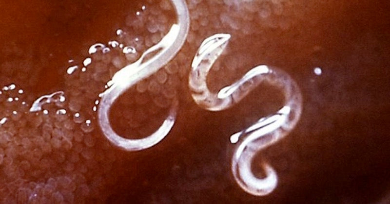 Parasite Cleanser